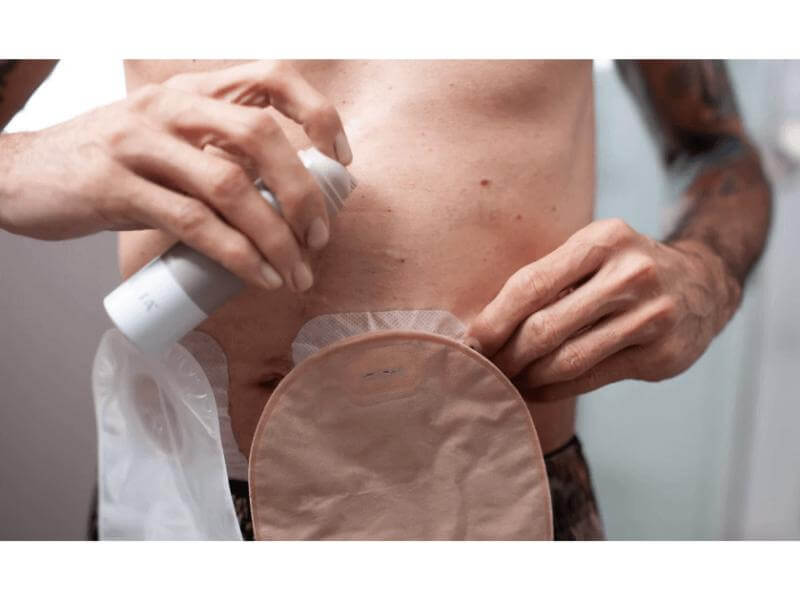 Microporous Surgical Tape (Wrapped)