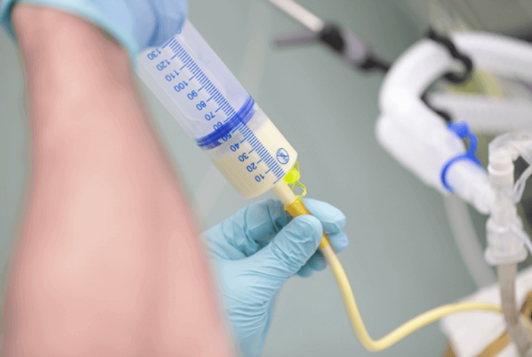 Foley Catheter 2-Way Open Ended 40cm with 10mL Balloon Unisex - All sizes